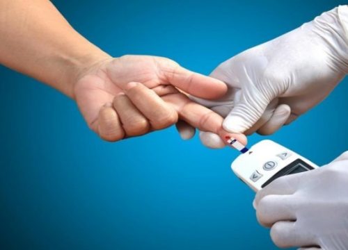 علائم پیش دیابت 