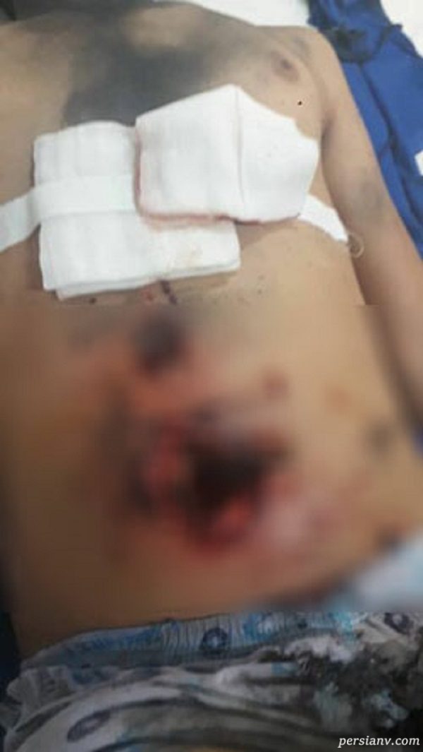 انفجار نارنجک دست‌ ساز