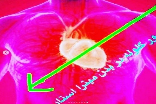 صحنه کشته شدن میترا استاد