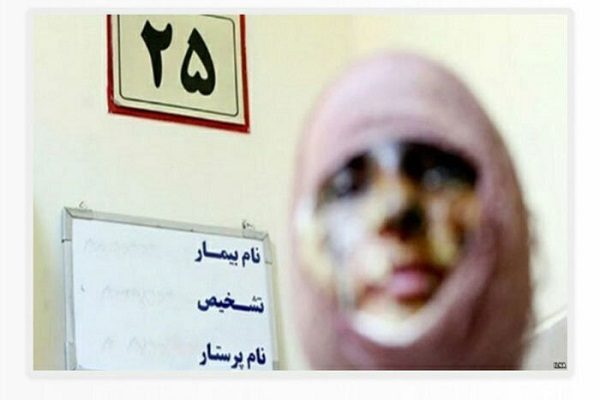 اسیدپاشی روی همسر