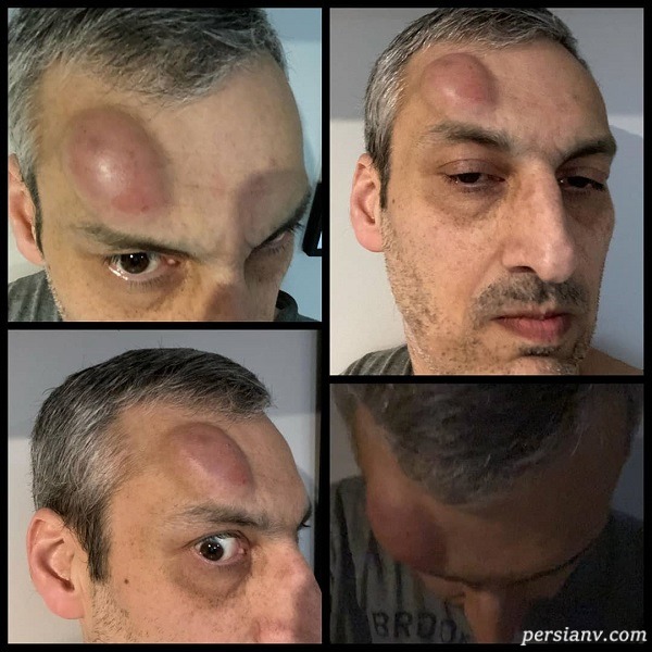بازیگر طنز ارژنگ امیرفضلی