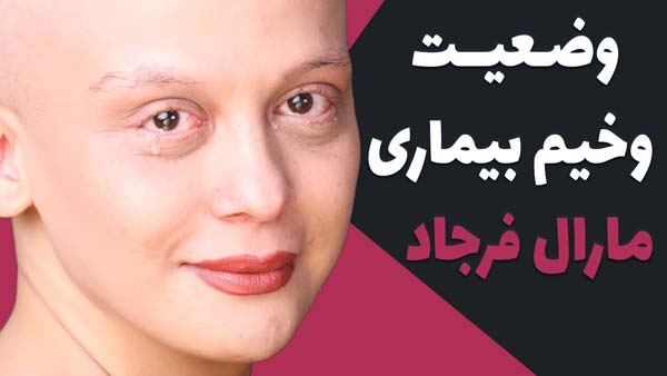 روزهای شیمی درمانی بازیگر ایرانی