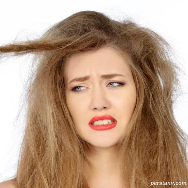 ریزش مو در بارداری