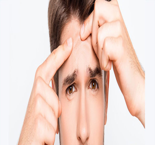 خوراکی های درمان جوش صورت