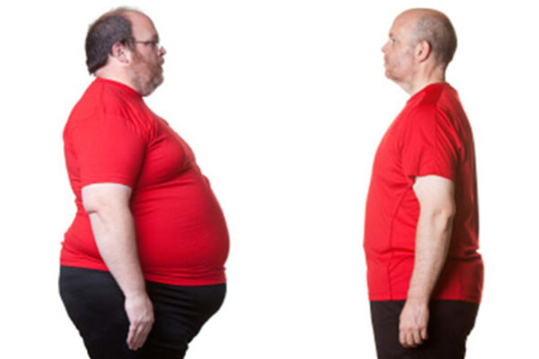 کاهش وزن زیاد
