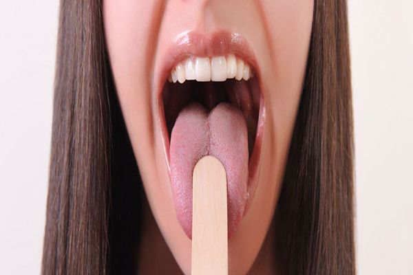عوارض تلخی دهان