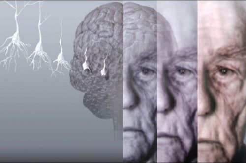 نابودی آلزایمر