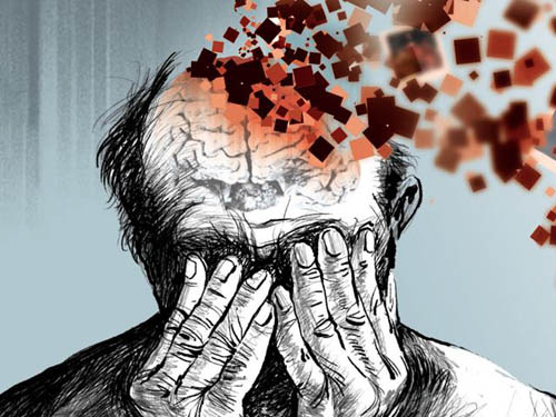 نشانه زوال عقل