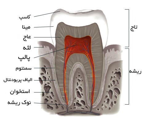 عصب کشی دندان