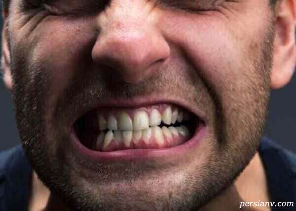 مقابله با دندان قروچه