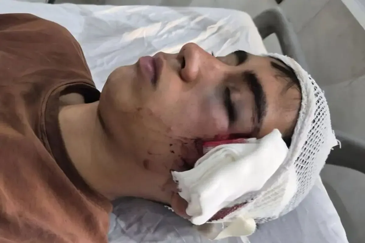 حمله معلم با دسته صندلی به دانشآموز در بم؛ مصدومیت شدید و بستری شدن در بیمارستان
