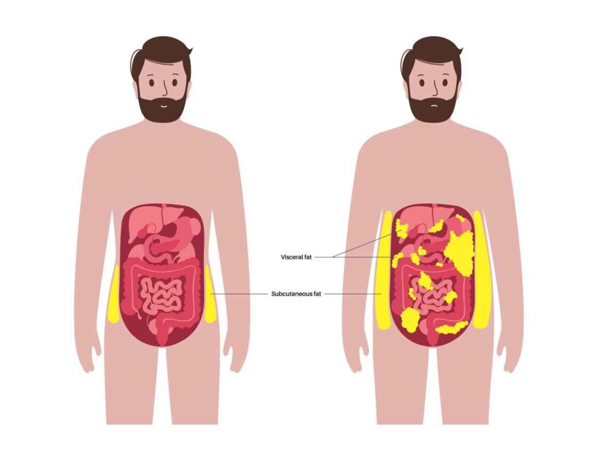 ذخیره چربی در ناحیه شکم ذخیره چربی در ناحیه شکم