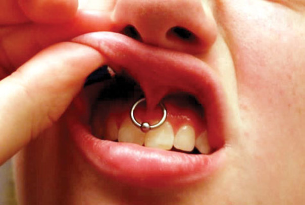 خطرات و عوارض سوراخ کردن بینی، زبان و لب