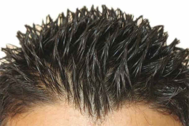 چرا موهای سرم بوی بد میدهد