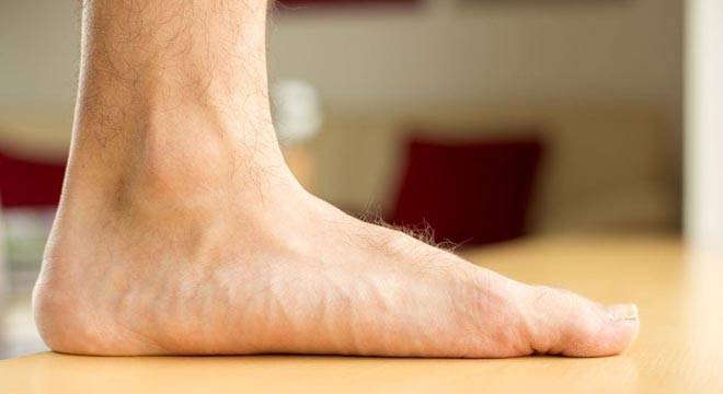 صافی کف پا چه مشکلاتی برای انسان ایجاد میکند؟