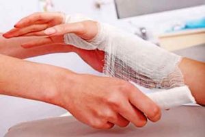 سوختگی در آشپزخانه | چه اقداماتی را انجام دهیم؟
