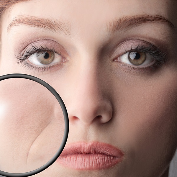 موثرترین روش ها برای از بین بردن خط خنده و پیشگیری از ایجاد خط خنده