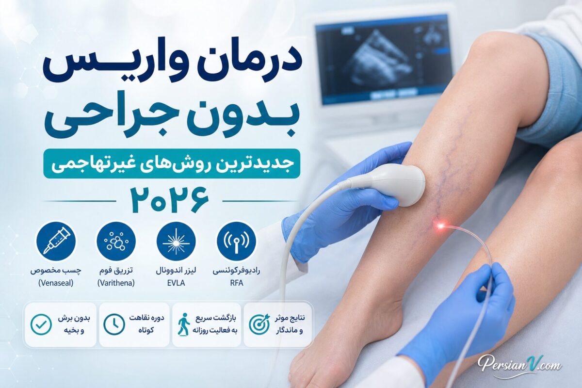 جدیدترین روش‌های درمان واریس بدون جراحی ؛ از چسب مخصوص تا تزریق فوم