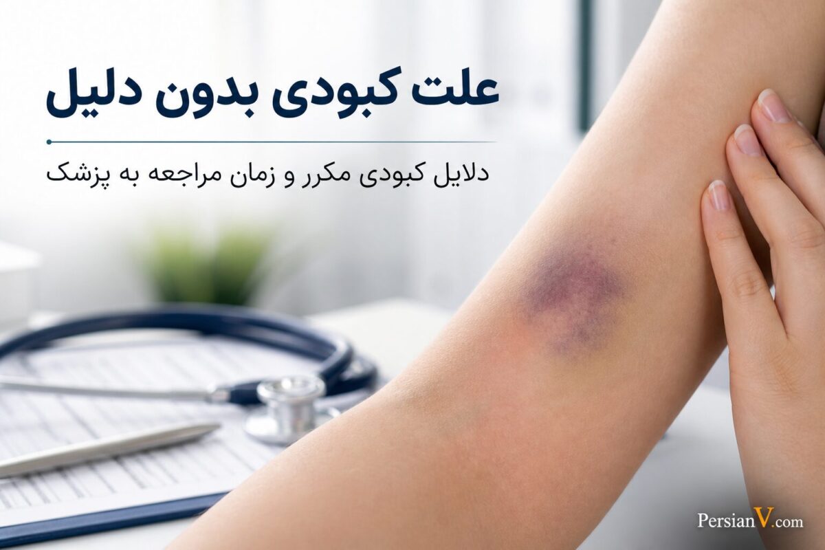 کبودی‌های بی‌دلیل روی بدن از کجا می‌آیند؟ این نشانه‌ها را جدی‌تر بگیرید
