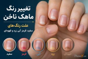 رنگ ماهک ناخن چه می‌گوید؟ از تغییرات بی‌خطر تا نشانه‌هایی که باید بررسی شوند