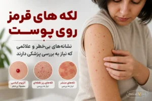لکههای قرمز روی پوست ؛ کدام بیخطرند و چه زمانی باید جدی گرفته شوند؟