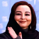 ماهایا پطروسیان قبل و بعد از عمل / آیا چهره او تغییر کرده است؟ + تصاویر