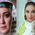شوکه شدن هواداران از ظاهر جدید الهام حمیدی / چه اتفاقی برای این بازیگر افتاده؟ + عکس