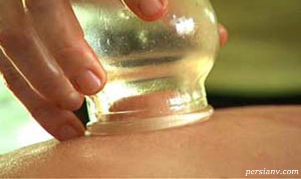 تعبیر خواب حجامت ، دیدن حجامت در خواب چه تعبیری دارد ؟
