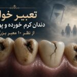 تعبیر خواب دندان کرم خورده و پوسیده از نظر ۱۰ معبر بزرگ - تعبیر خواب دندان کرم خورده