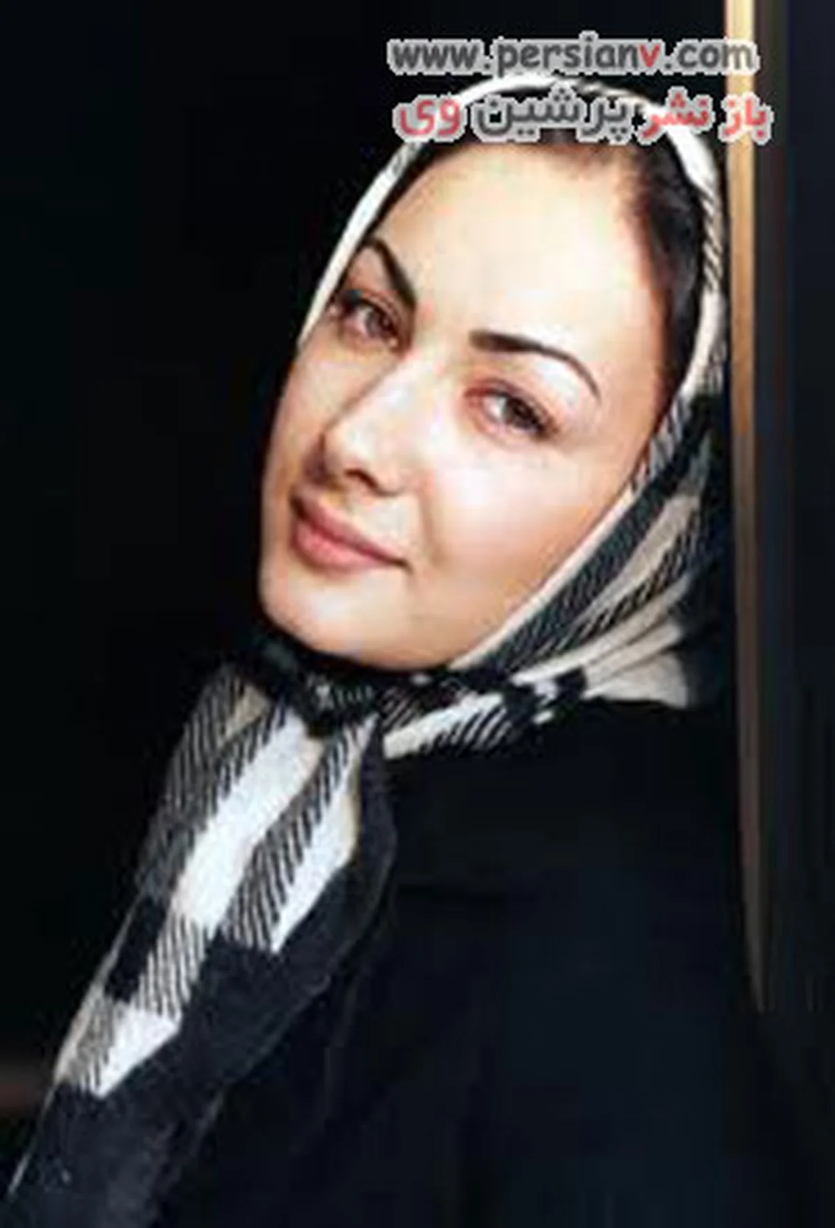 جراحی زیبایی ستاره های ایرانی