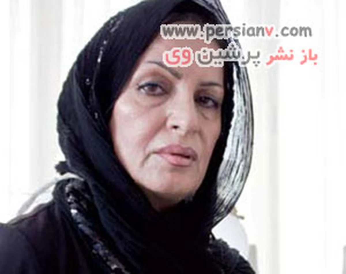 جراحی زیبایی ستاره های ایرانی