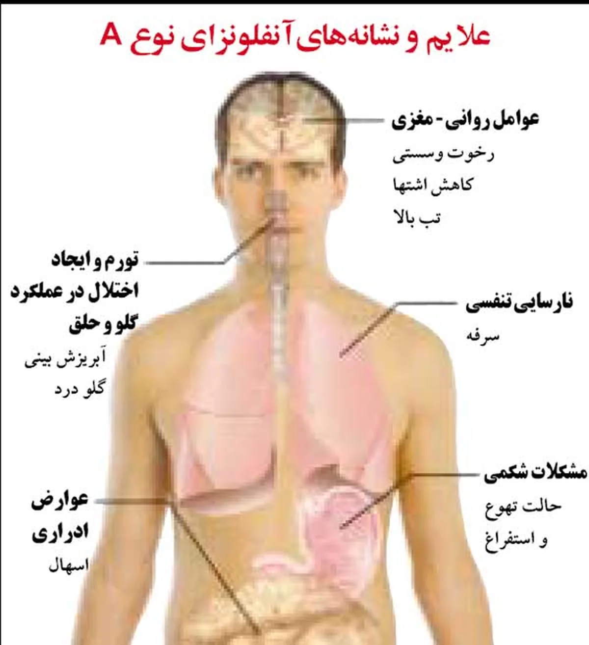 علائم آنفولانزای خوکی در کودکان علائم آنفولانزای خوکی در کودکان