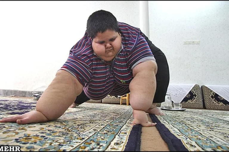 چاقترین پسر ایرانی؛ محسن پورمحمدی کیست و چرا اینقدر چاق است؟