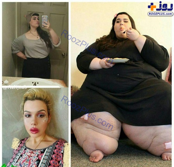 دختر 300 کیلویی قبل و بعد از کاهش وزن کاهش وزن دختر 300 کیلویی