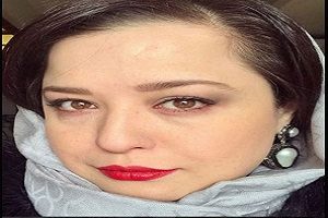 ماجرای خط روی پیشانی مهرآوه شریفی نیا چه بود؟!