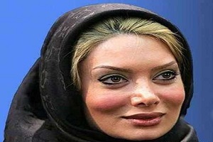 تغییر چهره و ظاهر محسوس نگار فروزنده بازیگر کم پیدا سینما