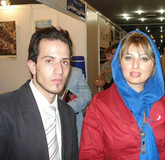 چهره نیوشا ضیغمی قبل از جراحی زیبایی نیوشا ضیغمی قبل از عمل زیبایی