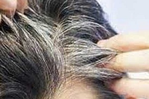 نکاتی درباره سفیدی مو که شاید نمی دانید!