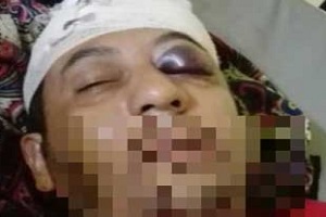 حمله خشونت آمیز به بهروز  بوچانی پناهجوی ایرانی در استرالیا!
