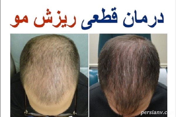 هشدار| فریب این تبلیغات پزشکی دروغین را نخورید!!