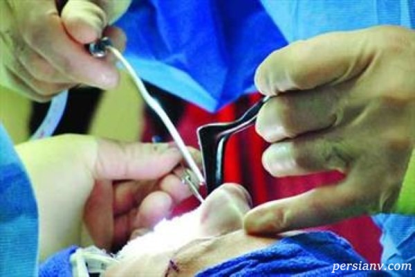 جراحی زیبایی تبلیغات پزشکی