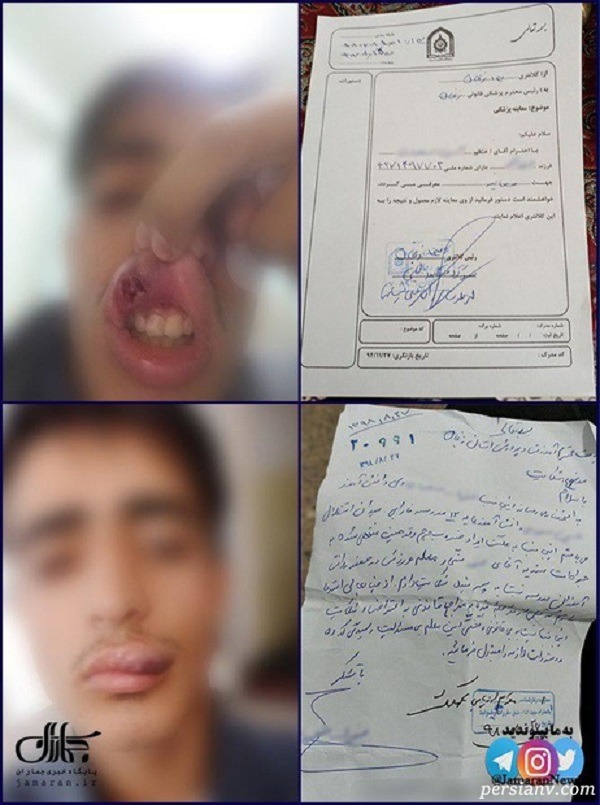مجروح شدن دانش آموز زنجانی دانش آموز زنجانی