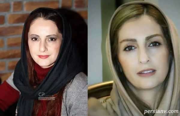 بازیگرانی که زیباتر شدند