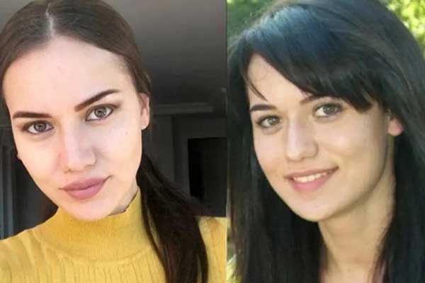 عکس های جدید از قبل و بعد جراحی زیبایی بازیگران ترکیه