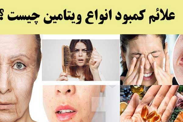 وقتی رنگ چهره خبر می دهد از کمبود ویتامین ها