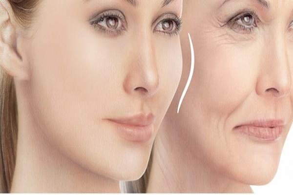 بهترین روش گونه گذاری