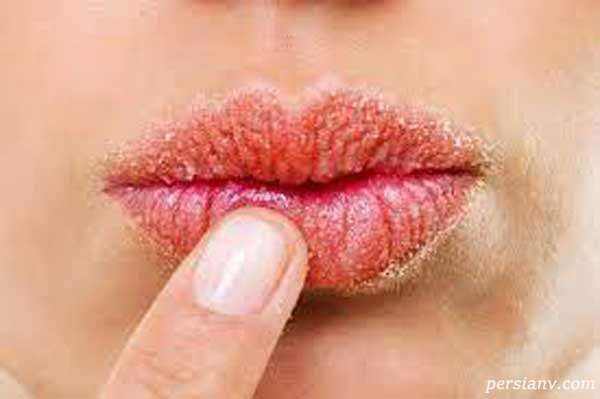 مرحله به مرحله ترمیم لب های ترک خورده پیش از استفاده از رژلب مایع مرحله به مرحله ترمیم لب های ترک خورده پیش از استفاده از رژلب مایع