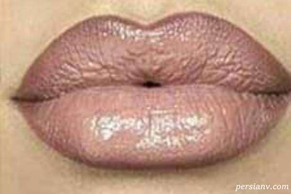 چگونه لبان برجسته ای بسان آنجلینا جولی داشته باشیم؟