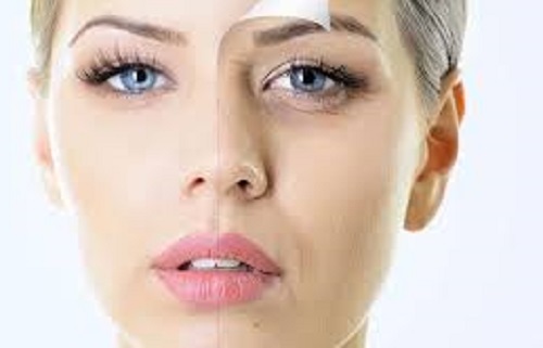 رفع چین و چروک پوست صورت رفع چین و چروک پوست