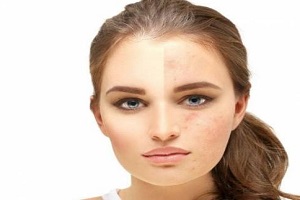 آموزش چند ماسک خانگی فوق العاده برای لطافت پوست و محو کردن لک ها